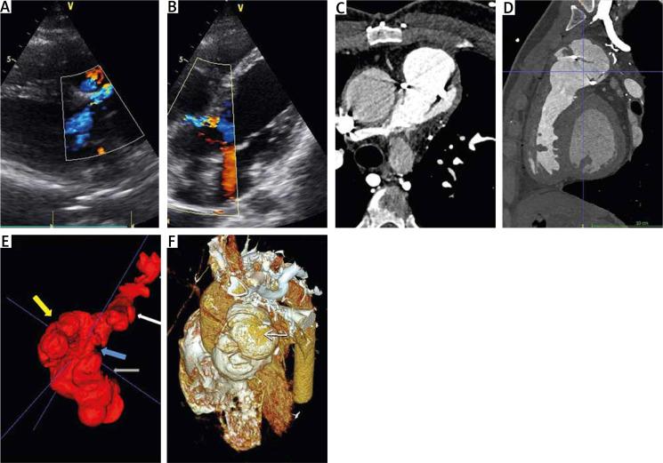 https://cdn.ncbi.nlm.nih.gov/pmc/blobs/3aa5/12019974/d0793dae1ed8/KITP-22-55761-g001.jpg