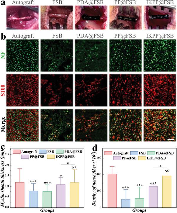 https://cdn.ncbi.nlm.nih.gov/pmc/blobs/3aa6/11336940/51f7778ce0ac/ADVS-11-2400827-g003.jpg