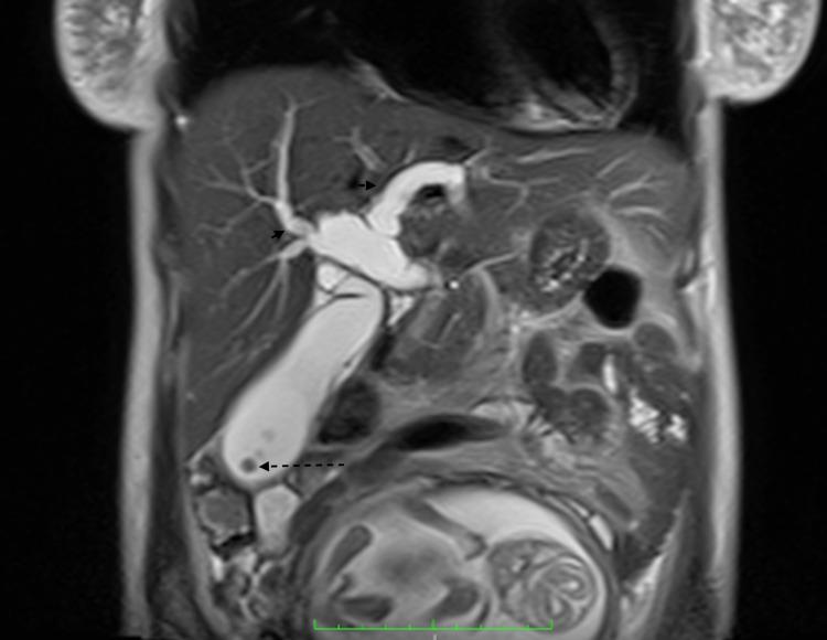 https://cdn.ncbi.nlm.nih.gov/pmc/blobs/3aa7/8958046/4e1878ceb379/cureus-0014-00000022610-i03.jpg