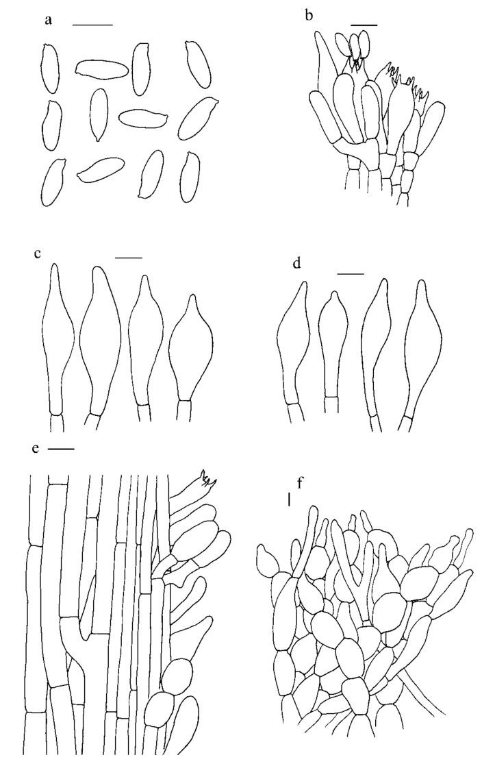 https://cdn.ncbi.nlm.nih.gov/pmc/blobs/3aa9/8539891/33d316d67f3c/jof-07-00823-g008.jpg