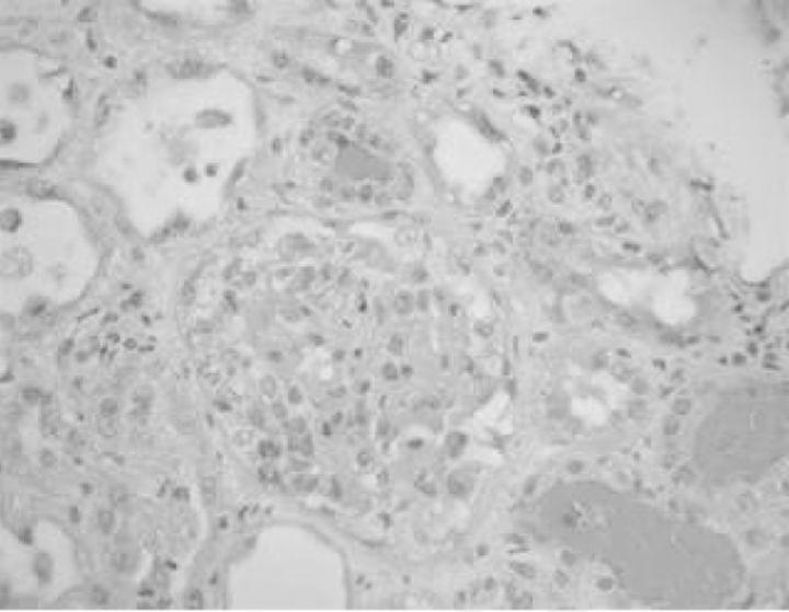 https://cdn.ncbi.nlm.nih.gov/pmc/blobs/3aae/4377755/f1642025e609/sfu03502.jpg