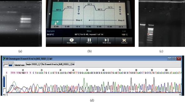 https://cdn.ncbi.nlm.nih.gov/pmc/blobs/3abb/9098347/a3eaabd35605/OMCL2022-5994033.001.jpg