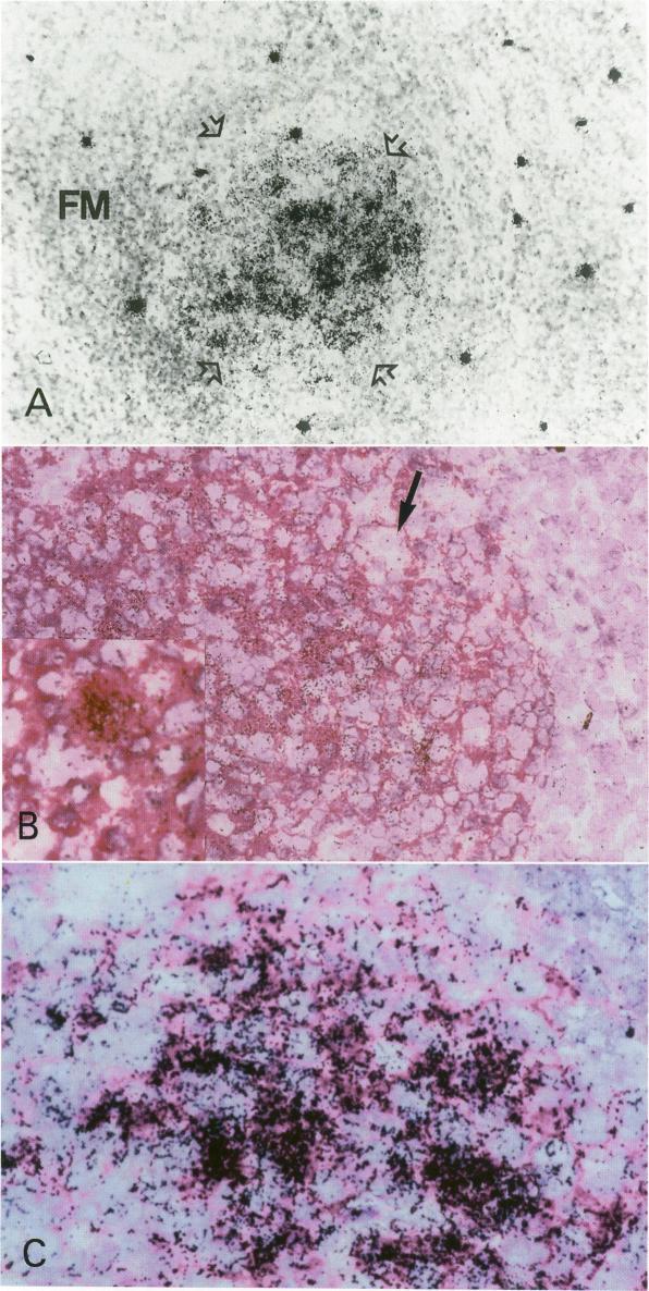 https://cdn.ncbi.nlm.nih.gov/pmc/blobs/3ac0/1886262/2987012ba002/amjpathol00085-0024-a.jpg