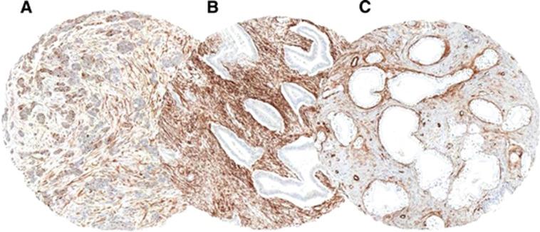 https://cdn.ncbi.nlm.nih.gov/pmc/blobs/3ac5/4229636/7d56d08e4240/bjc2014495f1.jpg