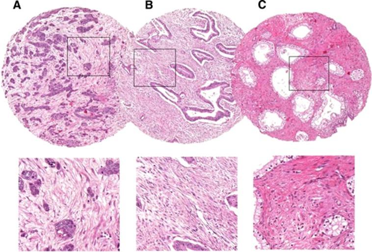 https://cdn.ncbi.nlm.nih.gov/pmc/blobs/3ac5/4229636/ca070667783d/bjc2014495f2.jpg