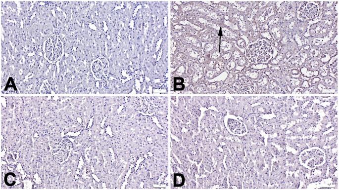 https://cdn.ncbi.nlm.nih.gov/pmc/blobs/3ac9/12205017/751afd9f9997/68_2025_2915_Fig4_HTML.jpg
