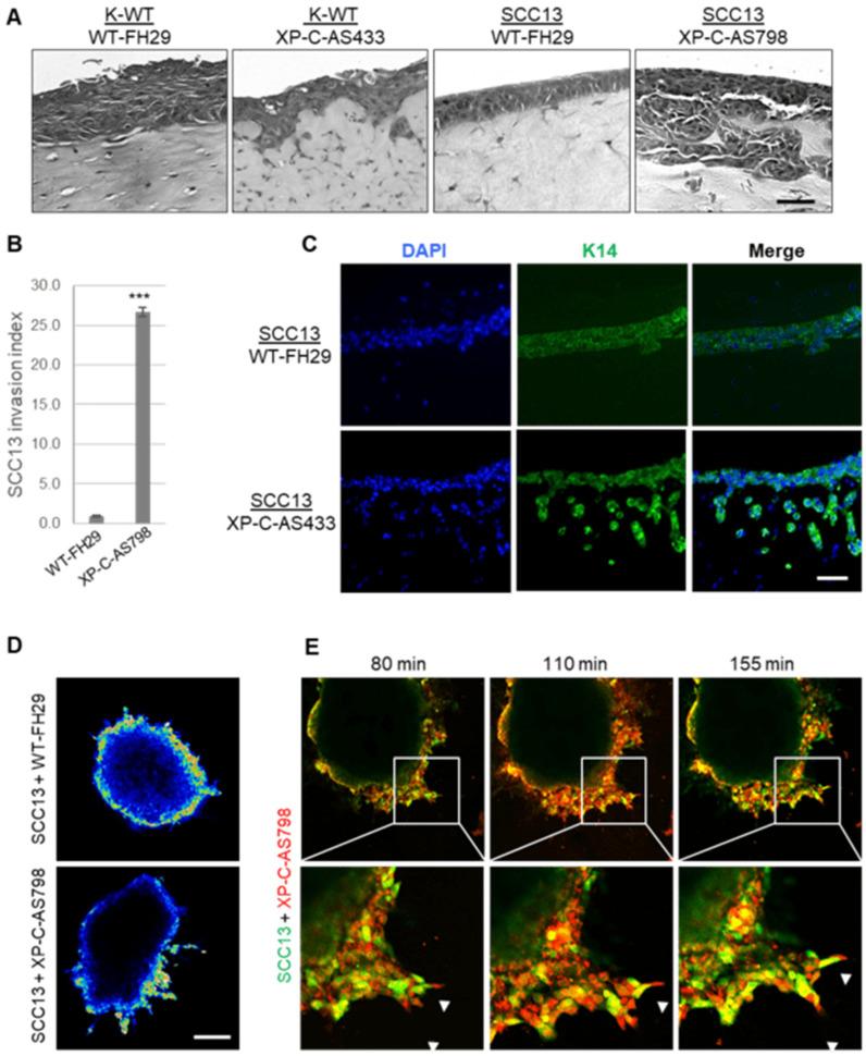 https://cdn.ncbi.nlm.nih.gov/pmc/blobs/3acc/11475422/d0e3b0609f57/cancers-16-03277-g001.jpg