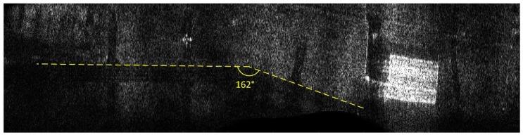 https://cdn.ncbi.nlm.nih.gov/pmc/blobs/3acc/6767291/cbce1d3d391e/sensors-19-03895-g016.jpg