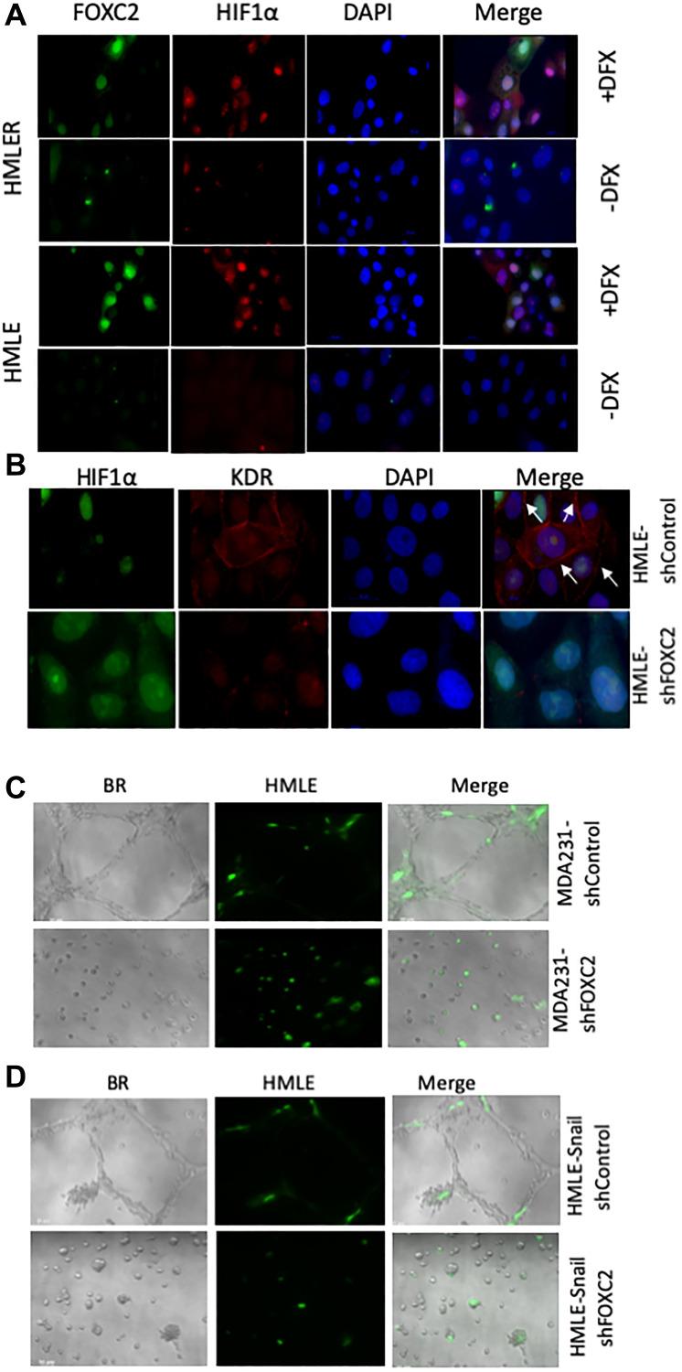 https://cdn.ncbi.nlm.nih.gov/pmc/blobs/3acc/8057273/da0287769d40/oncotarget-12-823-g006.jpg