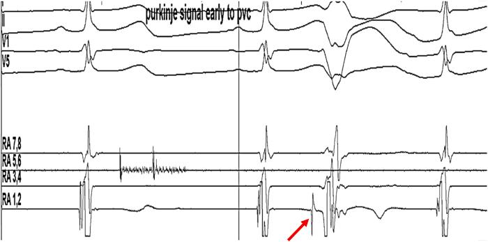 https://cdn.ncbi.nlm.nih.gov/pmc/blobs/3ad4/12138031/0d3158796549/gr2.jpg