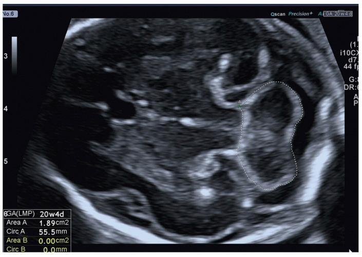 https://cdn.ncbi.nlm.nih.gov/pmc/blobs/3ada/10299055/2a8ed60433c1/jcm-12-04080-g001.jpg