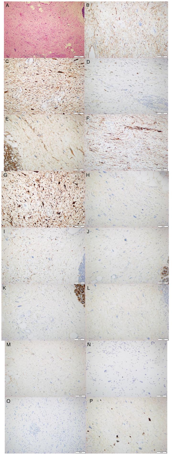 https://cdn.ncbi.nlm.nih.gov/pmc/blobs/3ada/11997640/248f61e141cc/ol-29-06-15014-g01.jpg
