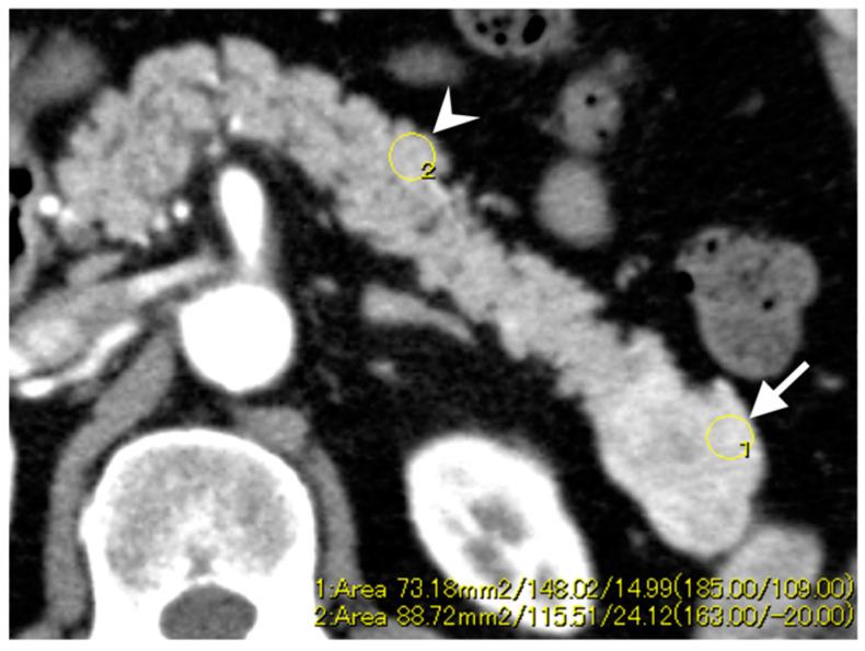 https://cdn.ncbi.nlm.nih.gov/pmc/blobs/3adf/7695321/3913a12a95fa/diagnostics-10-00919-g003.jpg