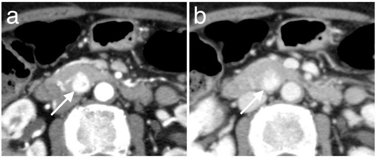 https://cdn.ncbi.nlm.nih.gov/pmc/blobs/3adf/7695321/4ee8bf514487/diagnostics-10-00919-g005.jpg