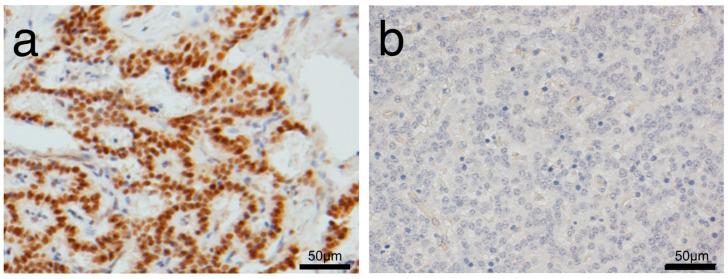 https://cdn.ncbi.nlm.nih.gov/pmc/blobs/3adf/7695321/791ab8b055d9/diagnostics-10-00919-g001.jpg