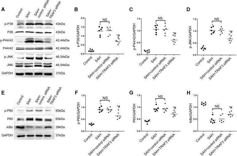 https://cdn.ncbi.nlm.nih.gov/pmc/blobs/3ae0/7790824/5f636643928f/41419_2020_3278_Fig6_HTML.jpg