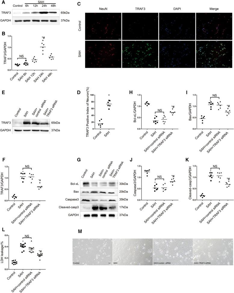 https://cdn.ncbi.nlm.nih.gov/pmc/blobs/3ae0/7790824/80dd8a69fe6f/41419_2020_3278_Fig5_HTML.jpg