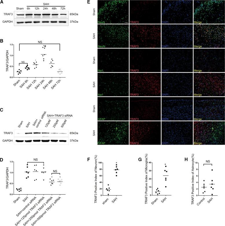 https://cdn.ncbi.nlm.nih.gov/pmc/blobs/3ae0/7790824/95d3f707bc72/41419_2020_3278_Fig2_HTML.jpg