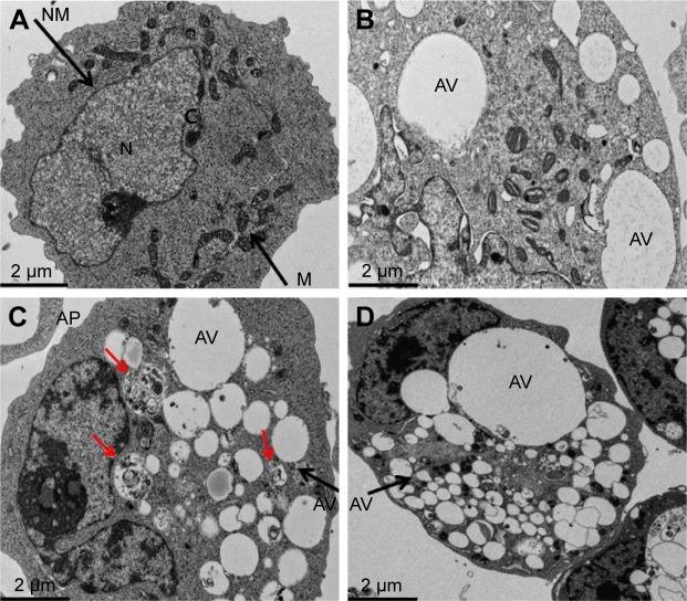 https://cdn.ncbi.nlm.nih.gov/pmc/blobs/3ae3/5566358/93ed718e4fa7/ijn-12-5819Fig10.jpg