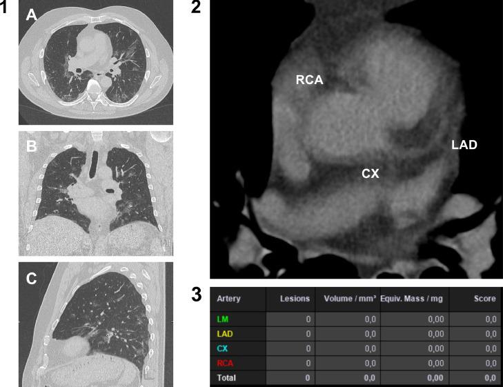 https://cdn.ncbi.nlm.nih.gov/pmc/blobs/3ae3/8882413/0ace09647e3d/gr3_lrg.jpg