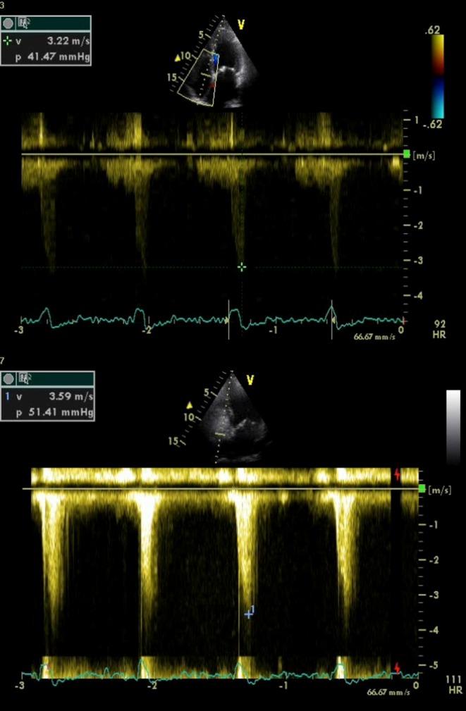 https://cdn.ncbi.nlm.nih.gov/pmc/blobs/3ae9/6055509/c8816cc21880/erp-5-G11-g003.jpg