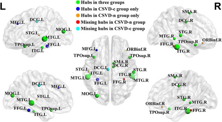 https://cdn.ncbi.nlm.nih.gov/pmc/blobs/3aed/9057099/10516f65715f/HBM-43-2607-g004.jpg