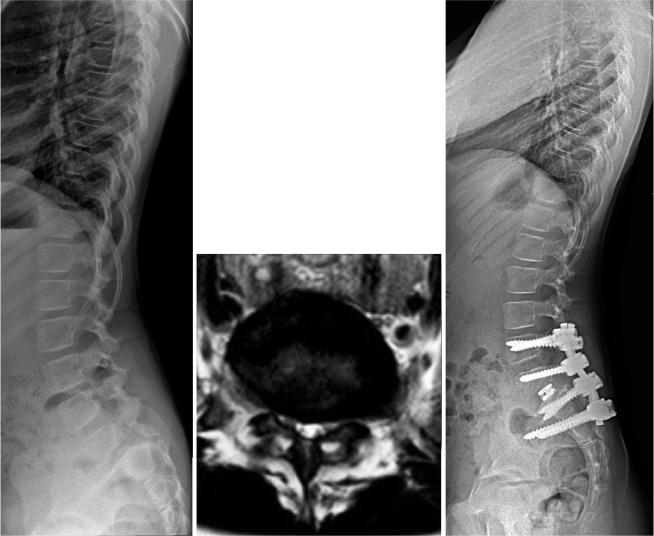 https://cdn.ncbi.nlm.nih.gov/pmc/blobs/3af7/11734530/56d79a52684f/ActaO-96-42450-g007.jpg