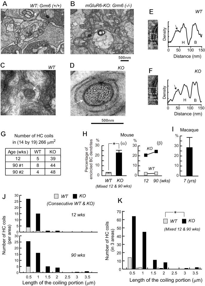 https://cdn.ncbi.nlm.nih.gov/pmc/blobs/3af7/7846946/de91931f5825/iovs-62-1-31-f003.jpg