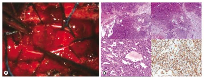 https://cdn.ncbi.nlm.nih.gov/pmc/blobs/3afe/5518430/0d8287af3fae/kjs-14-2-57f2.jpg