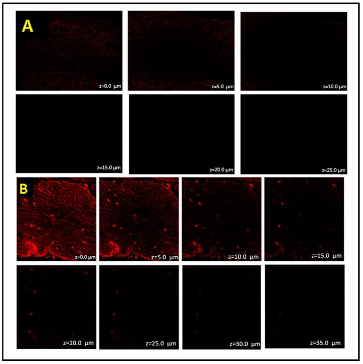 https://cdn.ncbi.nlm.nih.gov/pmc/blobs/3aff/10531150/194ef2ba25bb/gels-09-00752-g007.jpg