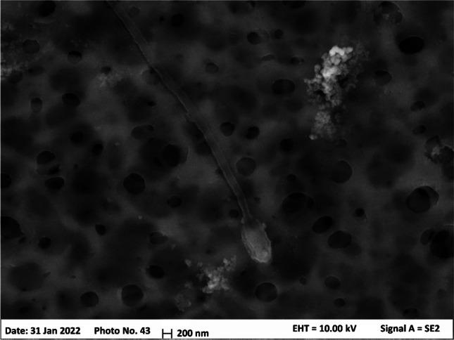 https://cdn.ncbi.nlm.nih.gov/pmc/blobs/3b08/11876234/3d9a3e2b0066/216_2025_5746_Fig5_HTML.jpg