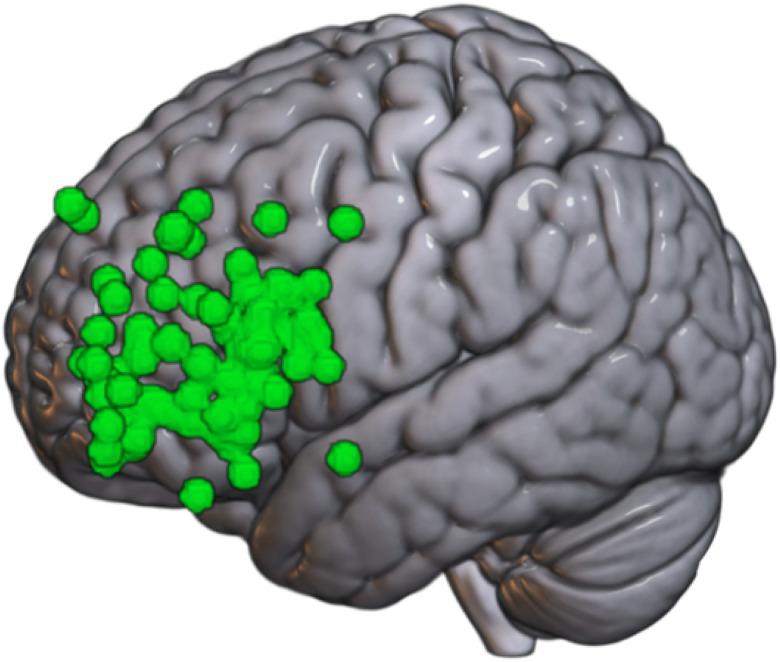 https://cdn.ncbi.nlm.nih.gov/pmc/blobs/3b08/12363917/186bea2ccb57/nihpp-rs7158945v1-f0002.jpg