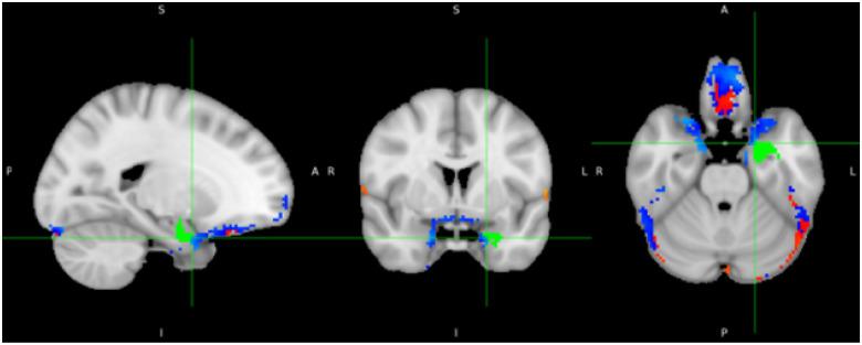 https://cdn.ncbi.nlm.nih.gov/pmc/blobs/3b08/12363917/97d720368173/nihpp-rs7158945v1-f0004.jpg