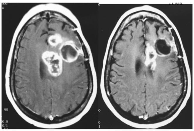 https://cdn.ncbi.nlm.nih.gov/pmc/blobs/3b09/6716053/4055124b8202/fendo-10-00565-g0003.jpg