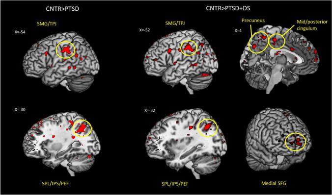 https://cdn.ncbi.nlm.nih.gov/pmc/blobs/3b0c/10657293/3cc181b5cd32/12311_2022_1467_Fig2_HTML.jpg