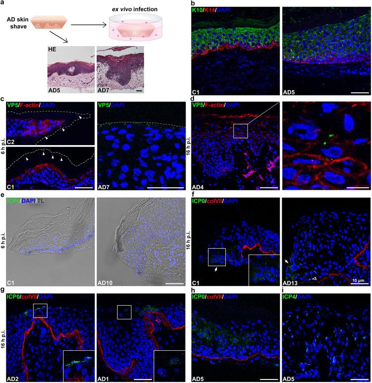 https://cdn.ncbi.nlm.nih.gov/pmc/blobs/3b11/9472615/515f6d8635d6/jvi.00864-22-f001.jpg
