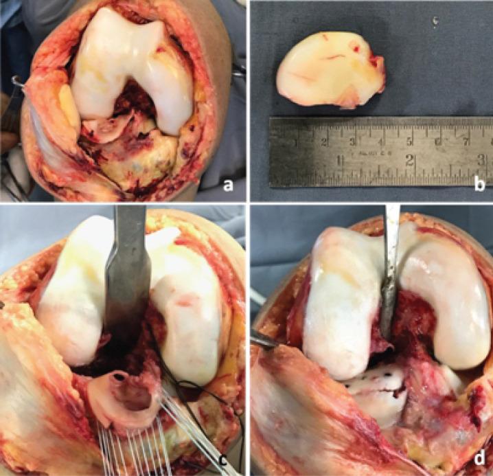 https://cdn.ncbi.nlm.nih.gov/pmc/blobs/3b16/8051566/dfd6a29e2e39/JOCR-10-36-g005.jpg