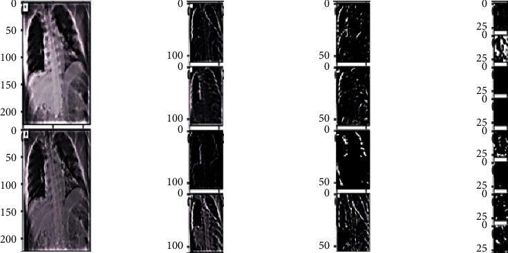 https://cdn.ncbi.nlm.nih.gov/pmc/blobs/3b18/9295614/5d1d5a7bbbc5/CIN2022-1953992.017.jpg