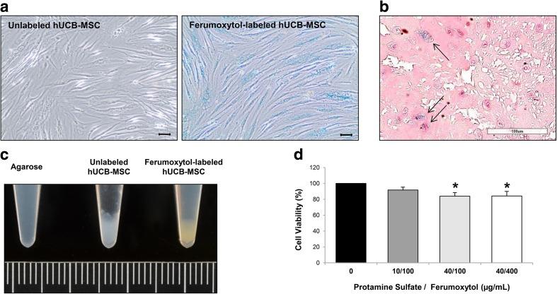 https://cdn.ncbi.nlm.nih.gov/pmc/blobs/3b1c/5346117/08003893918f/12015_2016_9694_Fig1_HTML.jpg