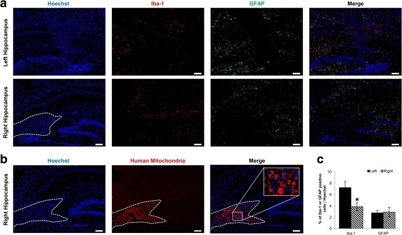 https://cdn.ncbi.nlm.nih.gov/pmc/blobs/3b1c/5346117/0e05c8c2bf3a/12015_2016_9694_Fig6_HTML.jpg
