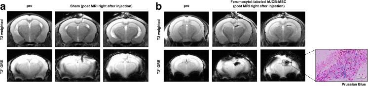 https://cdn.ncbi.nlm.nih.gov/pmc/blobs/3b1c/5346117/2d68fe90bdf6/12015_2016_9694_Fig3_HTML.jpg