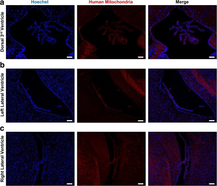 https://cdn.ncbi.nlm.nih.gov/pmc/blobs/3b1c/5346117/9e80b160c4ee/12015_2016_9694_Fig5_HTML.jpg