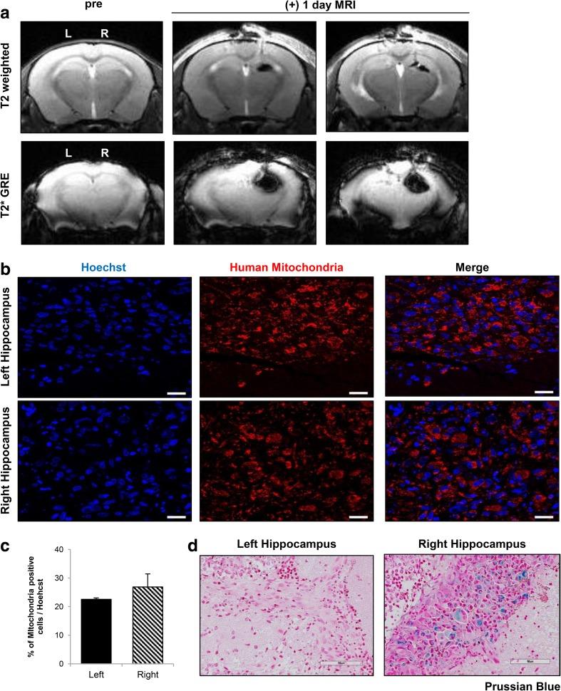 https://cdn.ncbi.nlm.nih.gov/pmc/blobs/3b1c/5346117/ab5c5a74f614/12015_2016_9694_Fig4_HTML.jpg