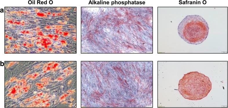 https://cdn.ncbi.nlm.nih.gov/pmc/blobs/3b1c/5346117/c90a29ff18a7/12015_2016_9694_Fig2_HTML.jpg
