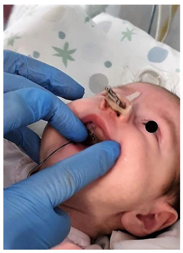 https://cdn.ncbi.nlm.nih.gov/pmc/blobs/3b2a/11119934/b8559d943071/children-11-00554-g002.jpg