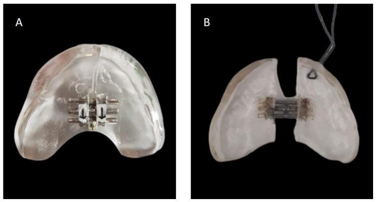 https://cdn.ncbi.nlm.nih.gov/pmc/blobs/3b2a/11119934/cf2ccffe45ca/children-11-00554-g003.jpg