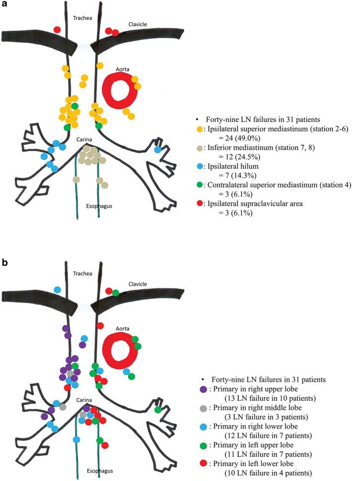 https://cdn.ncbi.nlm.nih.gov/pmc/blobs/3b2b/5668518/c4d05facf974/TCA-8-620-g001.jpg