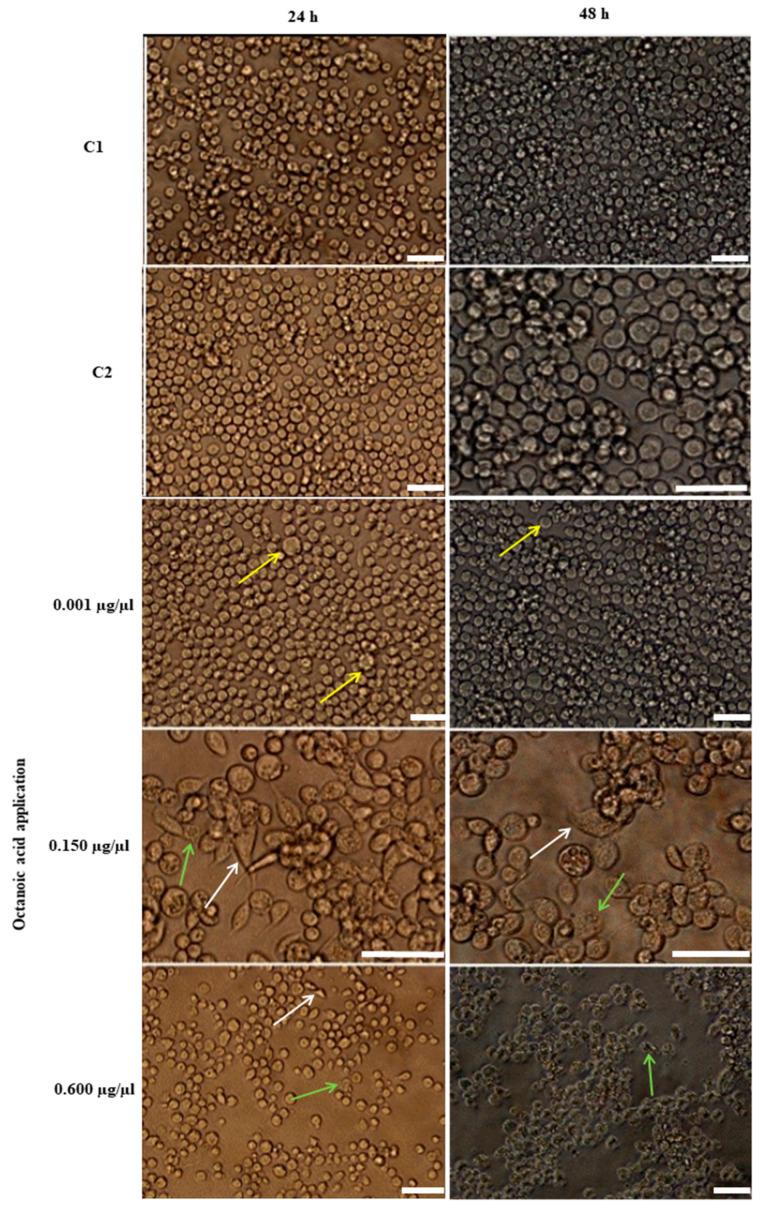 https://cdn.ncbi.nlm.nih.gov/pmc/blobs/3b31/9101785/317501359eba/ijms-23-05204-g005.jpg