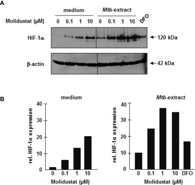 https://cdn.ncbi.nlm.nih.gov/pmc/blobs/3b36/8206807/4b17a32235c2/fimmu-12-678354-g002.jpg