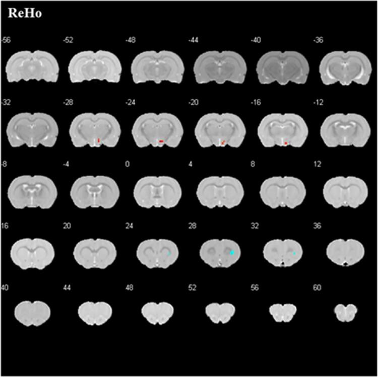 https://cdn.ncbi.nlm.nih.gov/pmc/blobs/3b3b/11365699/b2406bd2e3ff/qfae047f5.jpg